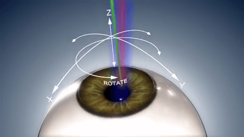 Annecy Laser Vision 20 Teneo Precision